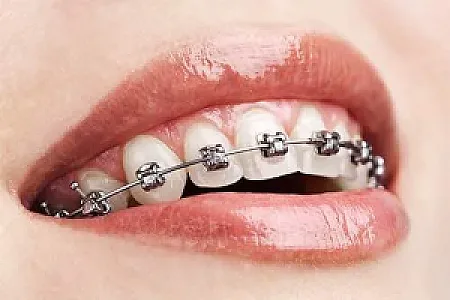 مطب ارتودنسی دکتر سارا محبوبی