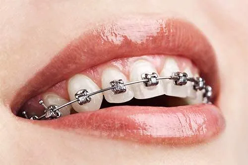 مطب ارتودنسی دکتر سارا محبوبی