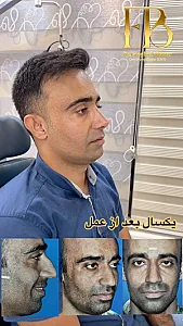 دکتر فائقه بنار جراح بینی بندر عباس