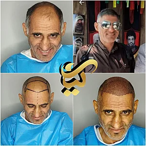 کلینیک پوست و مو اطهر