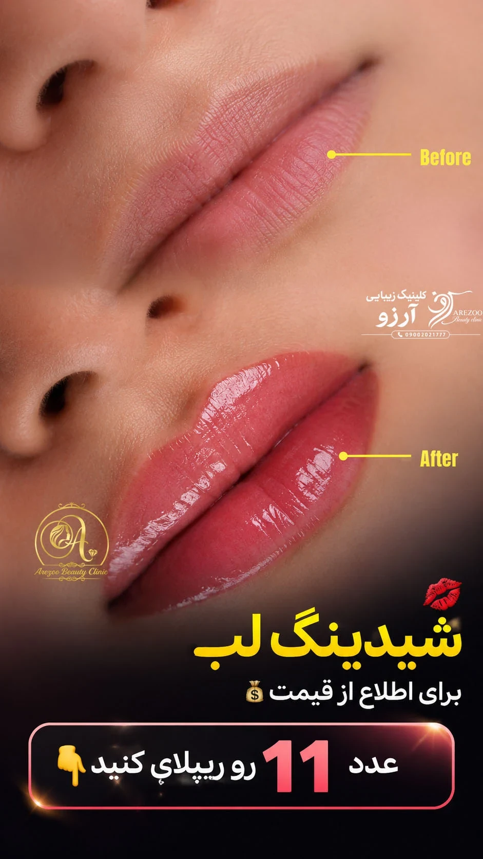 کلینیک زیبایی آرزو - تصویر 7