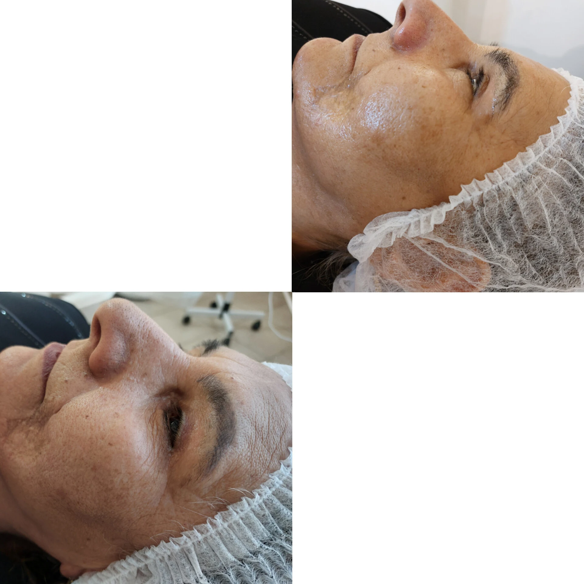 پاکسازی پوست وفیشال تخصصی فاطیما