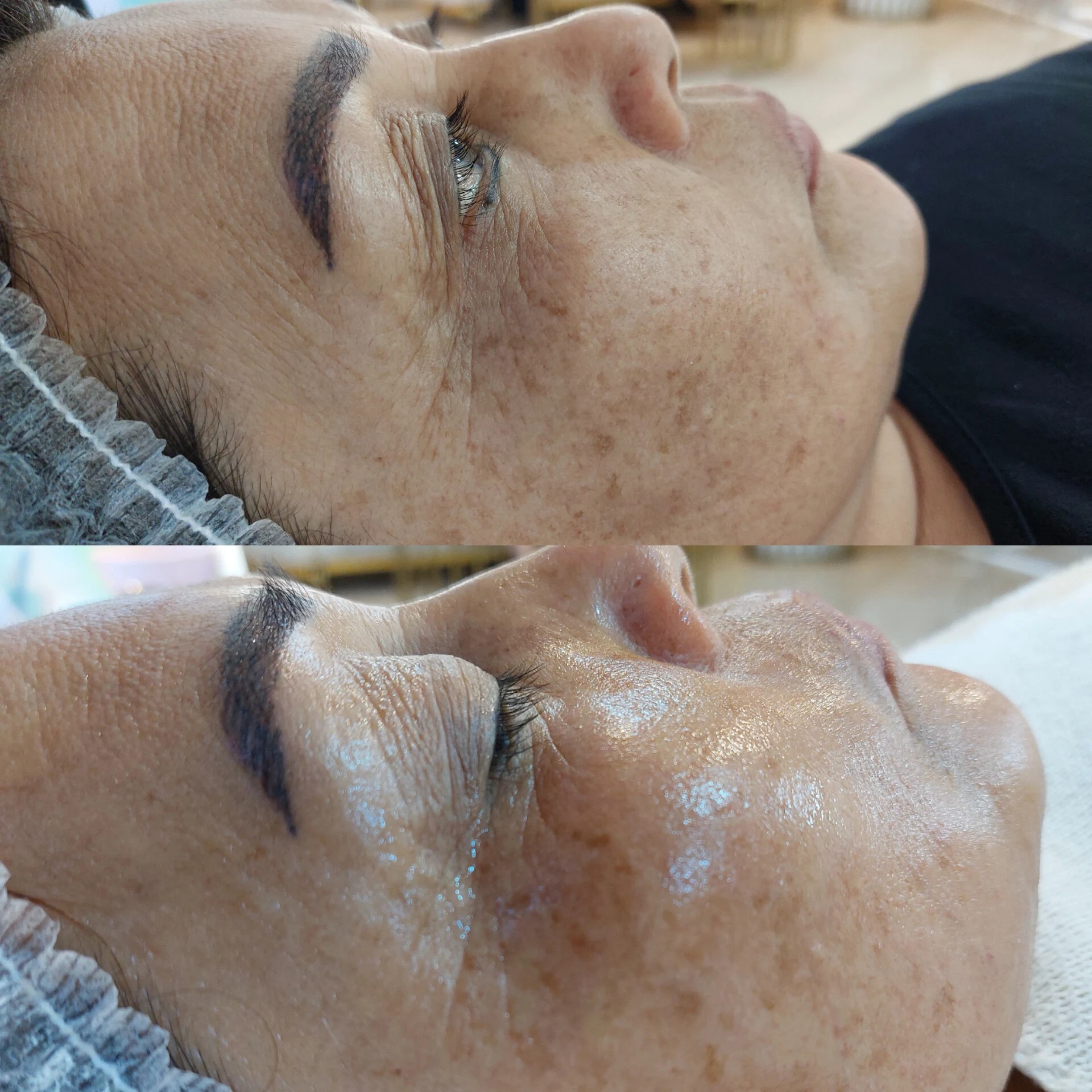 پاکسازی پوست وفیشال تخصصی فاطیما - تصویر 2