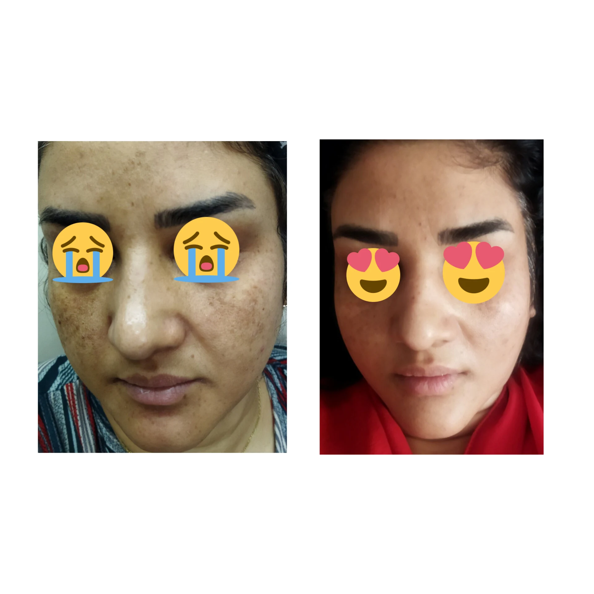 پاکسازی پوست وفیشال تخصصی فاطیما - تصویر 5