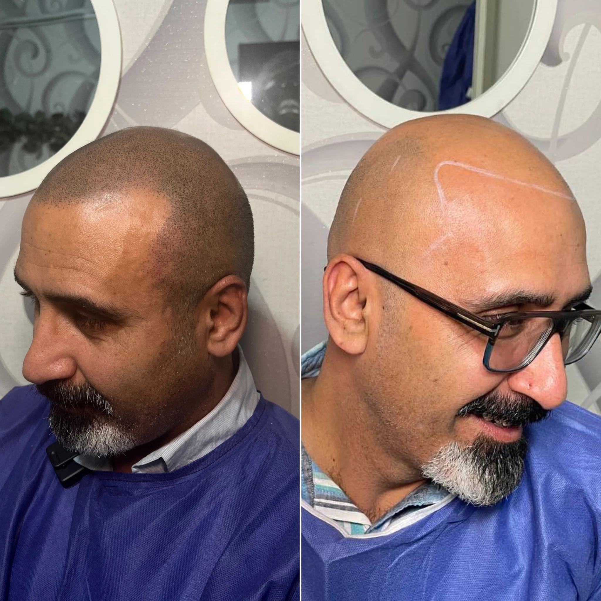 اولین مرکز میکرواسکالپ مشهد تاپ اسکالپ - تصویر 4