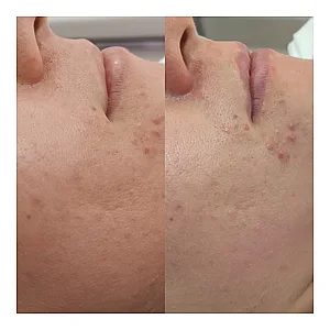 فیشیال تخصصی پیراپزشک فاطمه جلالی