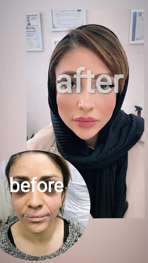 کلینیک تخصصی زیبایی دکتر بِد - کلینیک پوست و زیبایی در اراک - تصویر 2