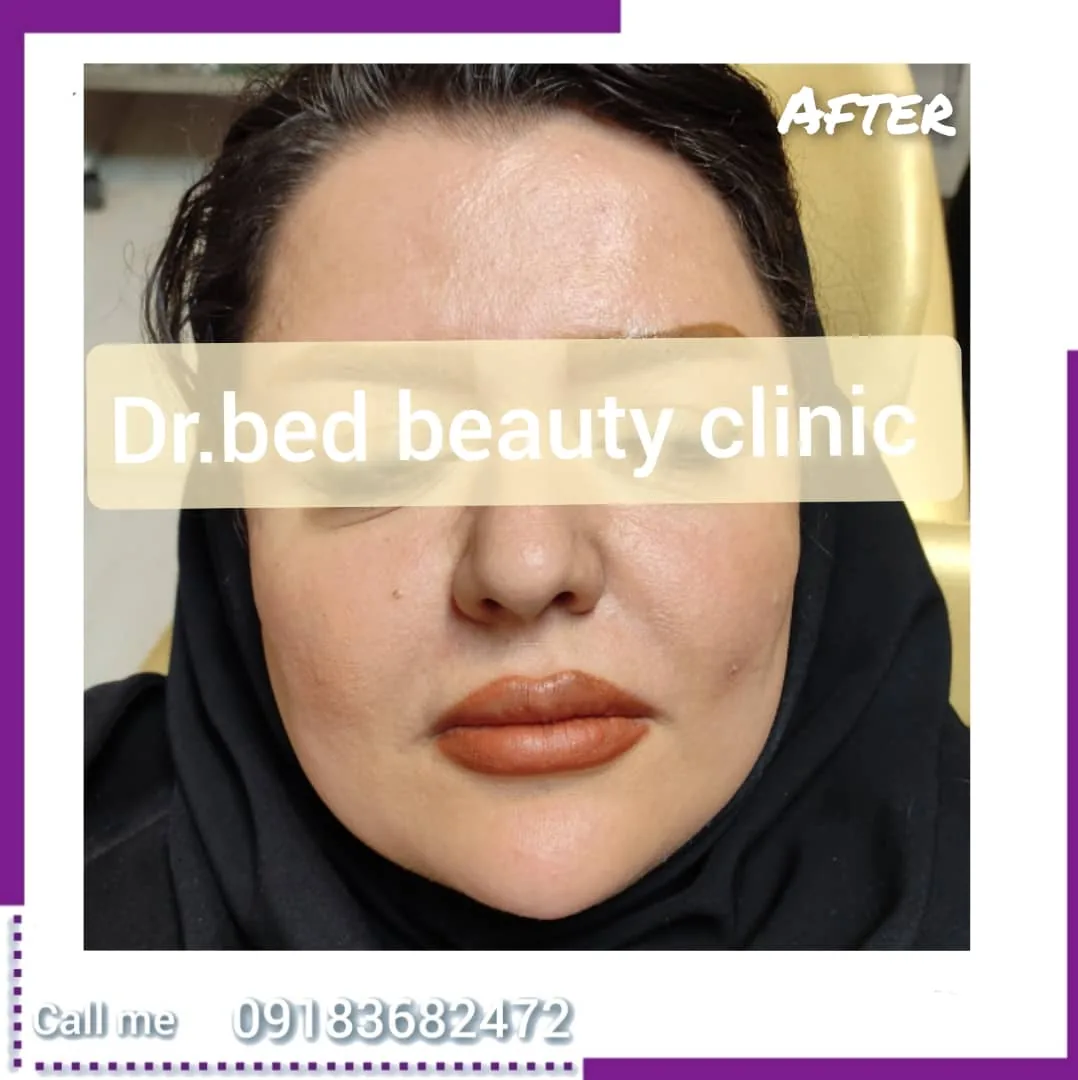 کلینیک تخصصی زیبایی دکتر بِد - کلینیک پوست و زیبایی در اراک - تصویر 6