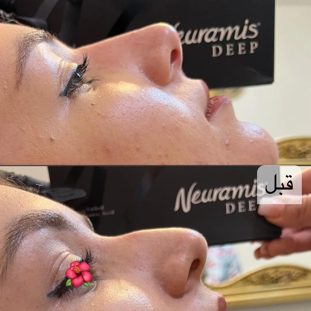 کلینیک پوست مو و زیبایی دکتر کاوئی - تصویر 2