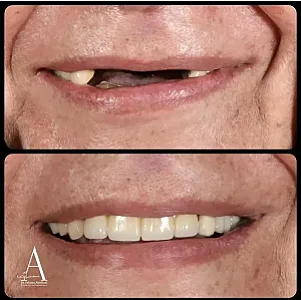 متخصص جراحی لثه و ایمپلنت