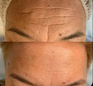 ژل و بوتاکس اهواز