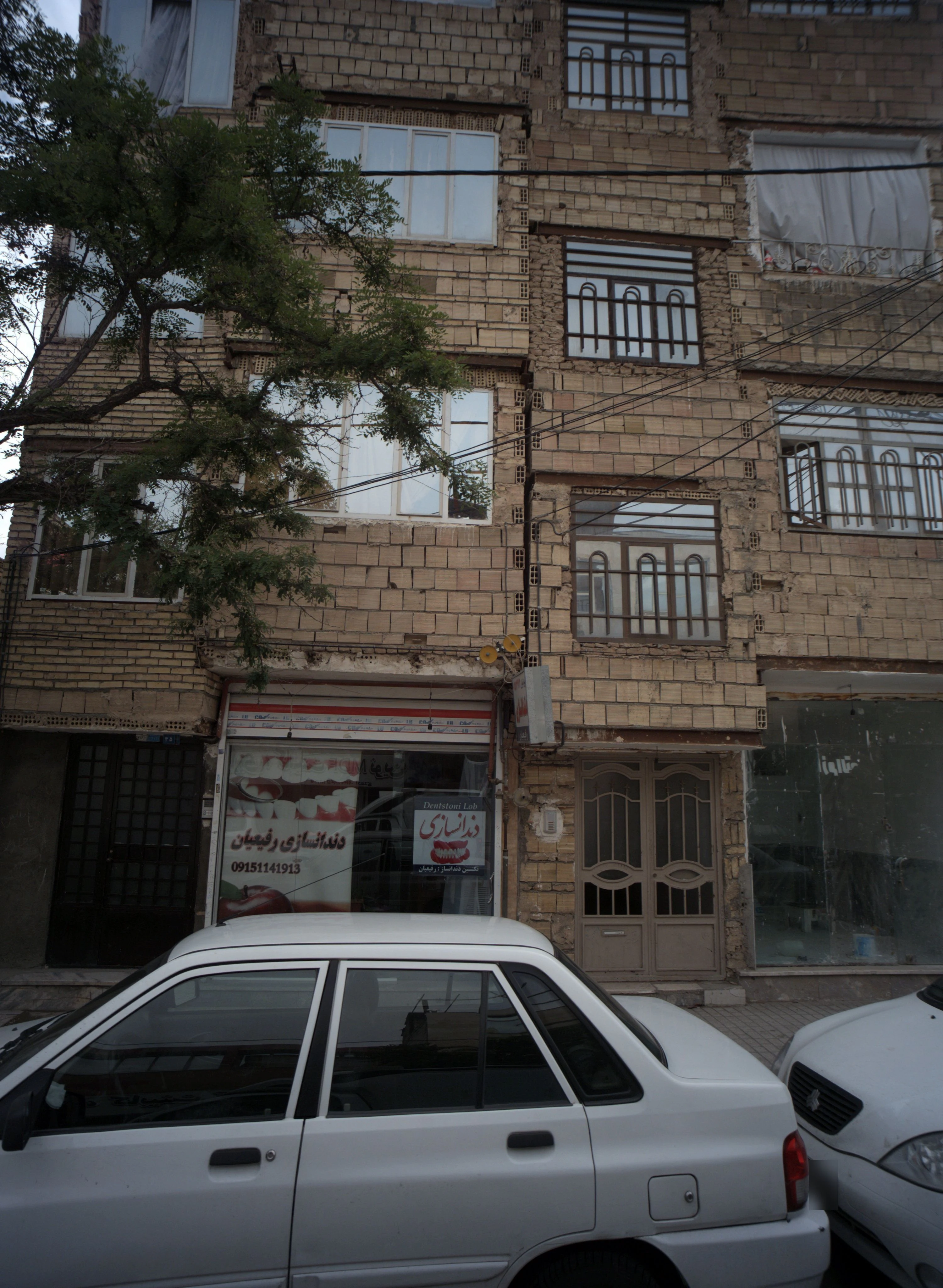 دندانسازی رفیعیان(پروتز کامل دندان) - دندانسازی و پروتز دندان در مشهد