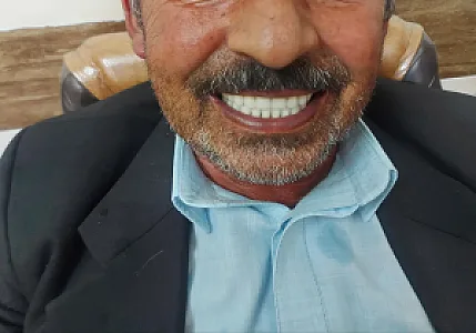 دندانسازی ترکان