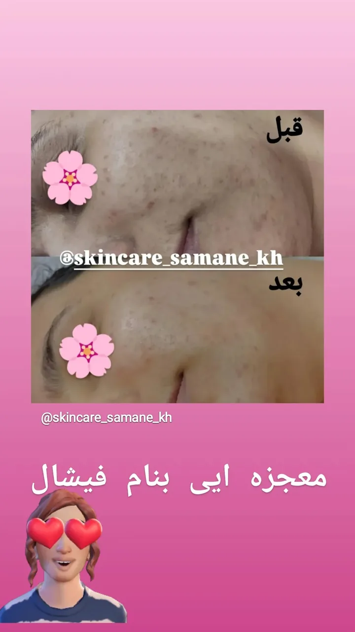 پاکسازی تخصصی پوست - تصویر 2