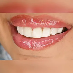کلینیک دندانپزشکی رز