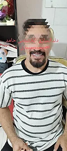 دندانسازی حامد نصیری (سانترال)