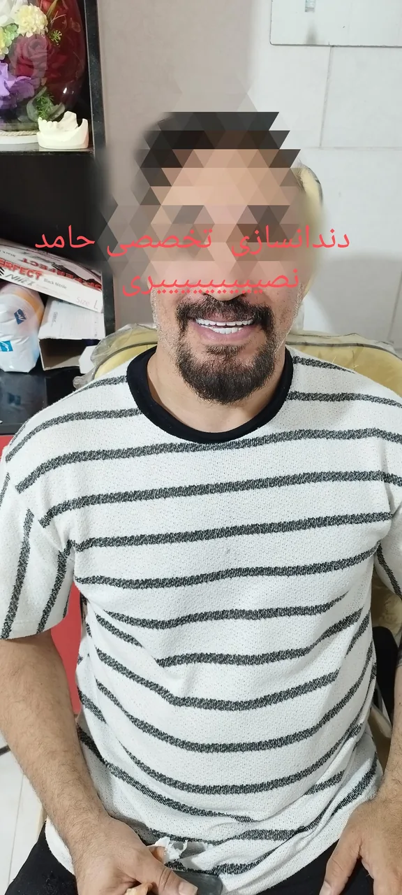دندانسازی حامد نصیری (سانترال)