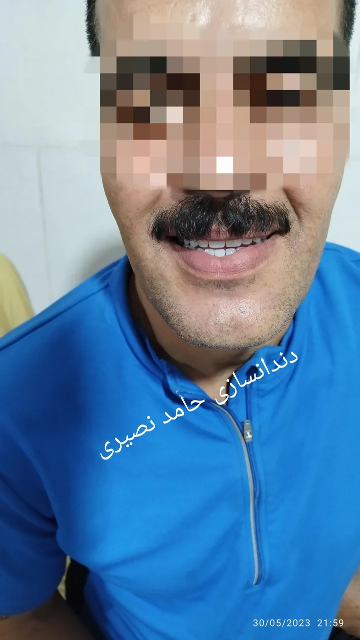 دندانسازی حامد نصیری (سانترال) - تصویر 5