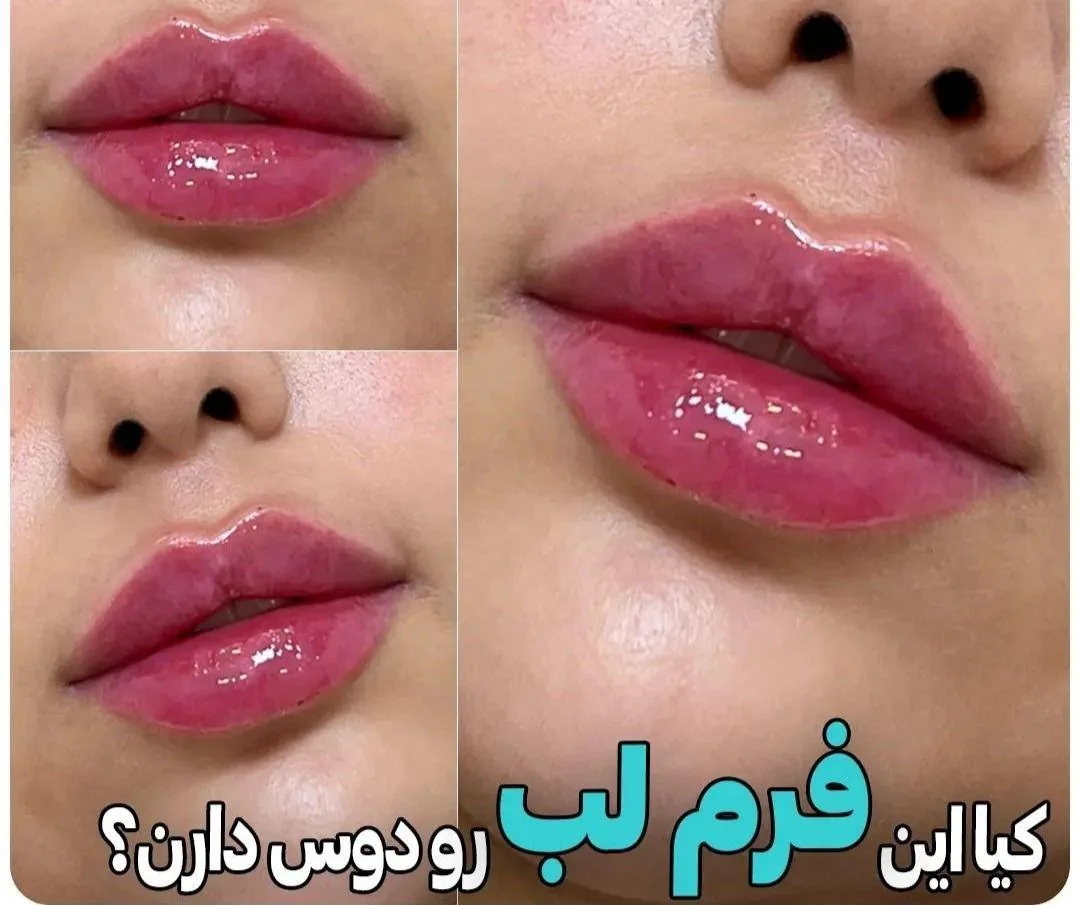 کلینیک لیزر و زیبایی نیوشا - تصویر 2