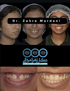 دکتر زهرا مردانی متخصص ارتودنسی