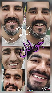 دندانسازی امین ملایی