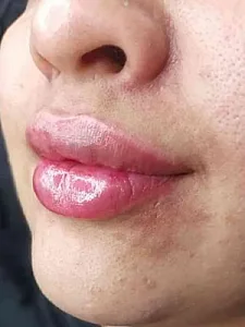 کلینیک زیبایی آیلین