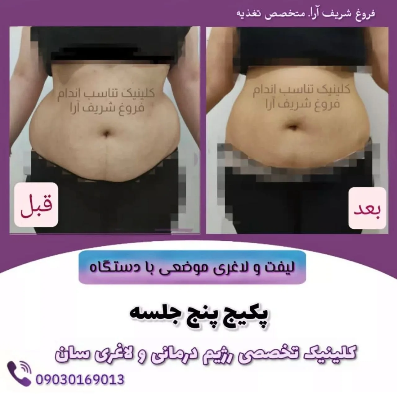 کلینیک تخصصی تغذیه و لاغری فروغ شریف آرا