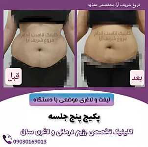 کلینیک تخصصی تغذیه و لاغری فروغ شریف آرا