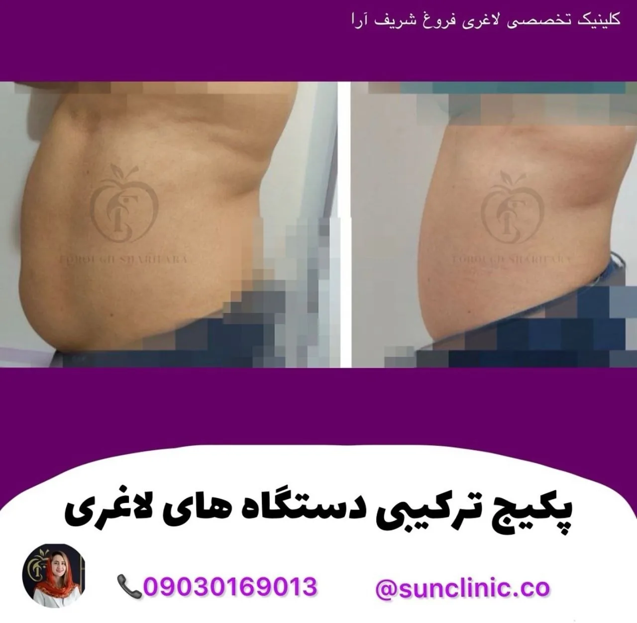 کلینیک تخصصی تغذیه و لاغری فروغ شریف آرا - تصویر 2