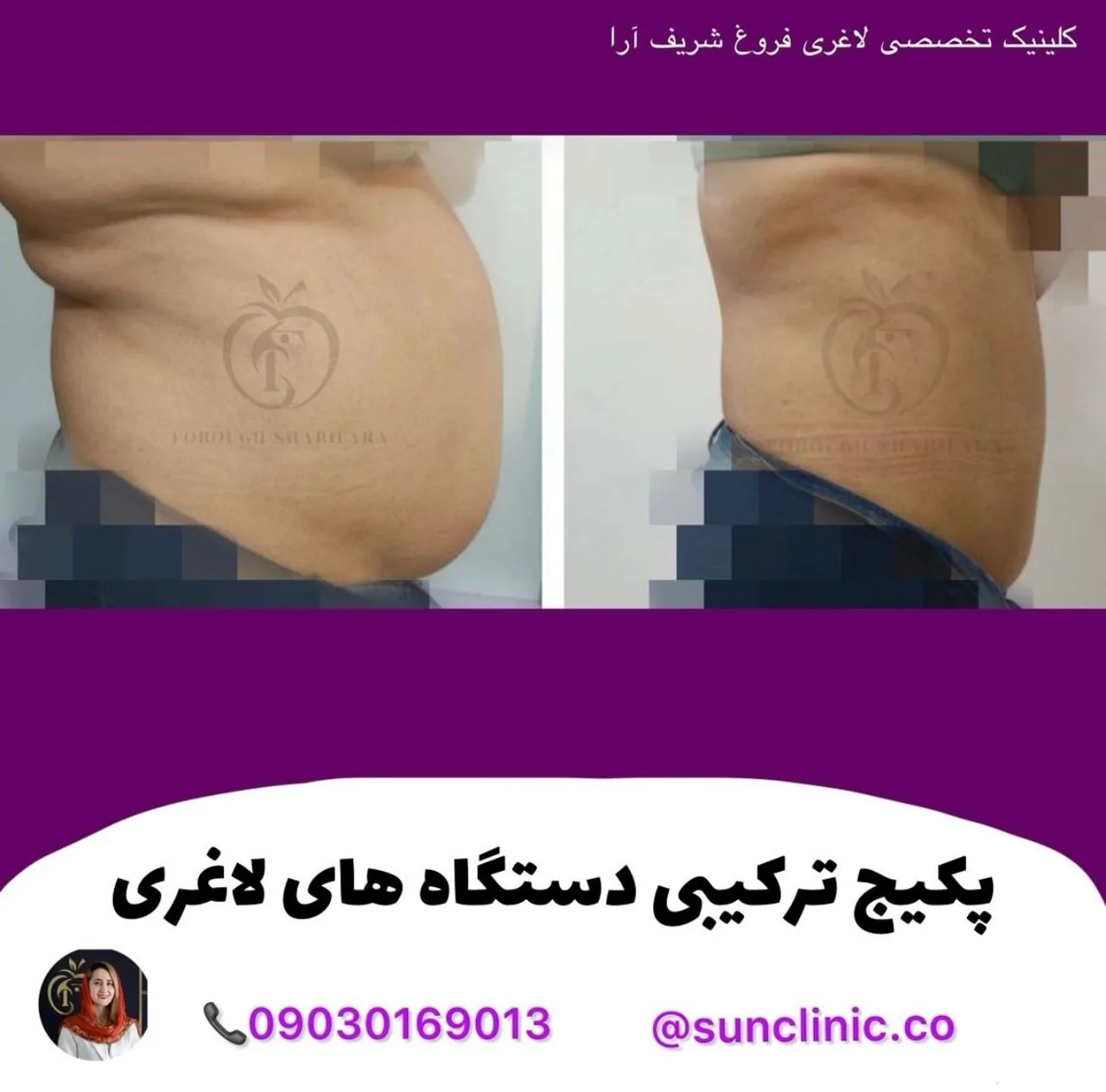 کلینیک تخصصی تغذیه و لاغری فروغ شریف آرا - تصویر 3