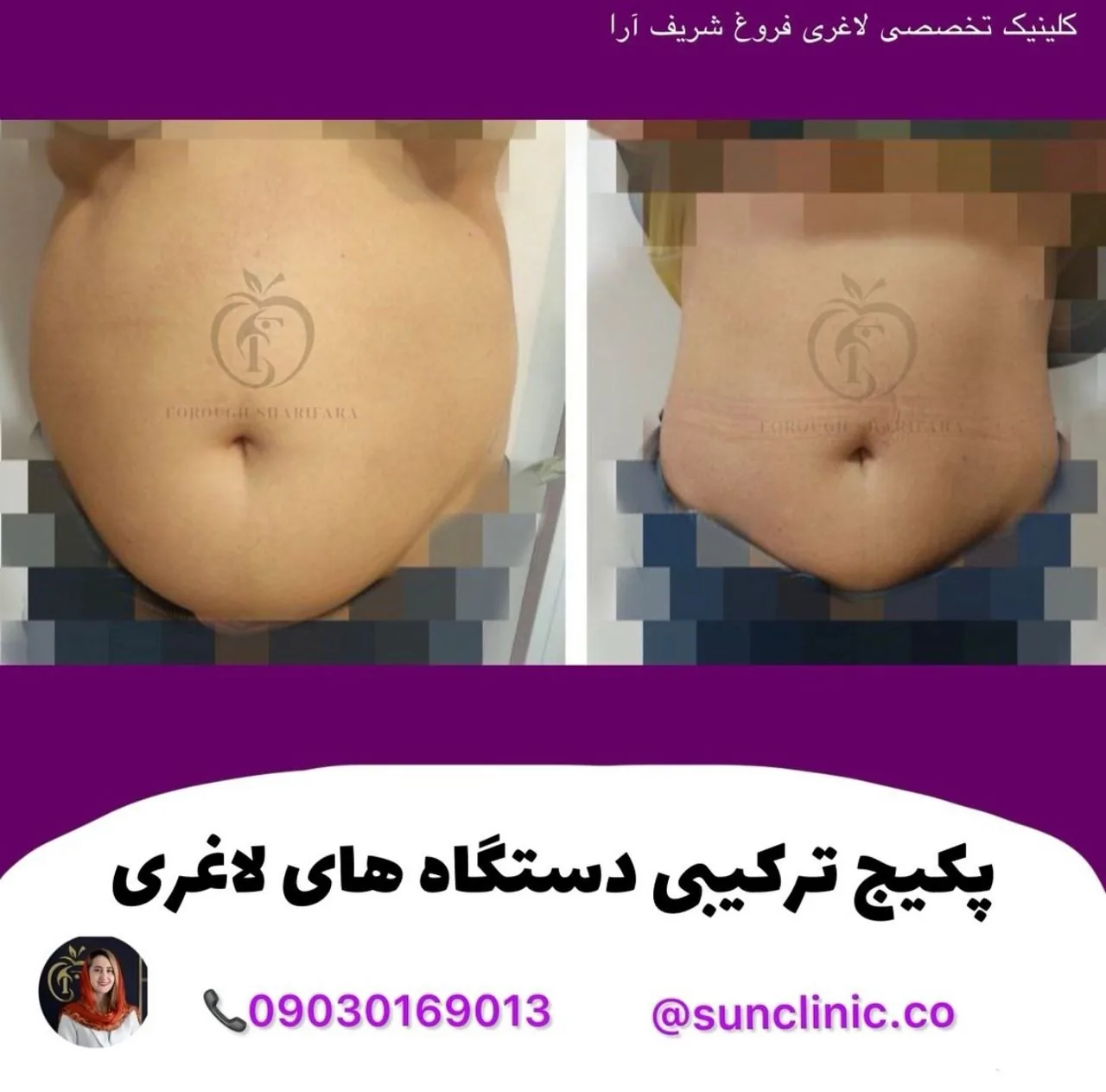 کلینیک تخصصی تغذیه و لاغری فروغ شریف آرا - تصویر 4