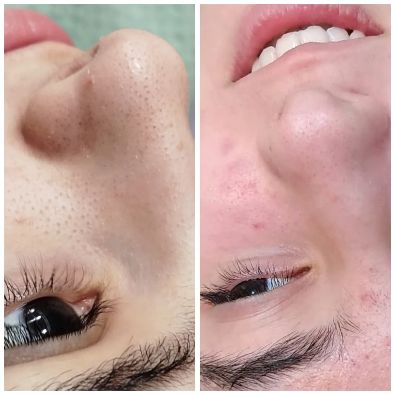 پاکسازی پوست بخشی