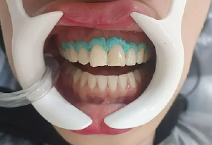 مطب دندانپزشکی خانم دکتر پریسا فروزنده