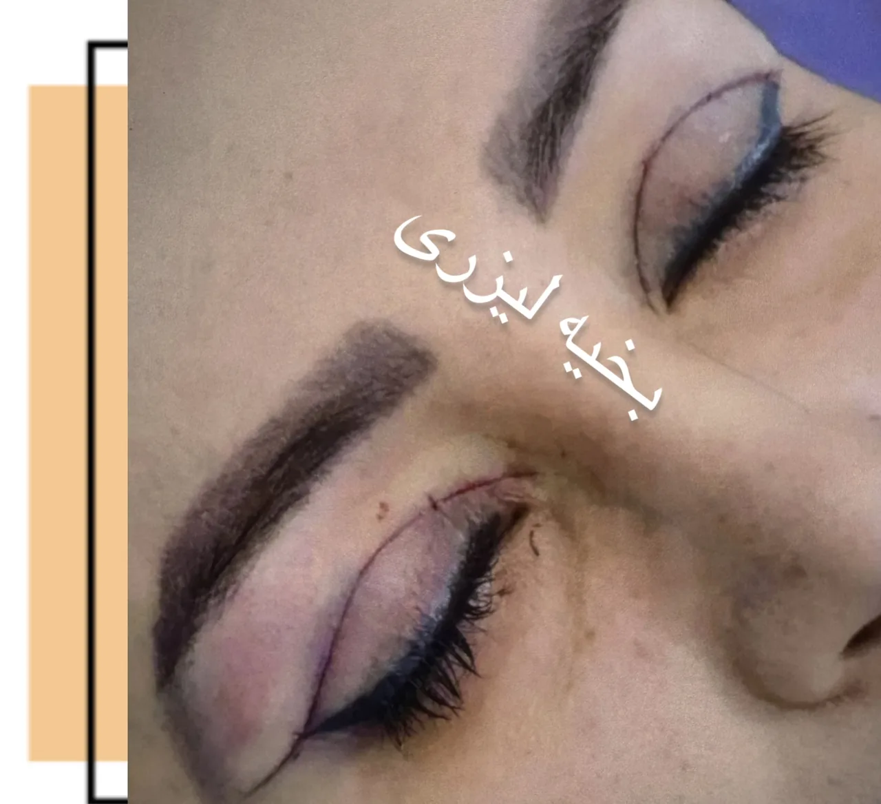 کلینیک زیبایی رایدو دکتر بهنام روایی - تصویر 2
