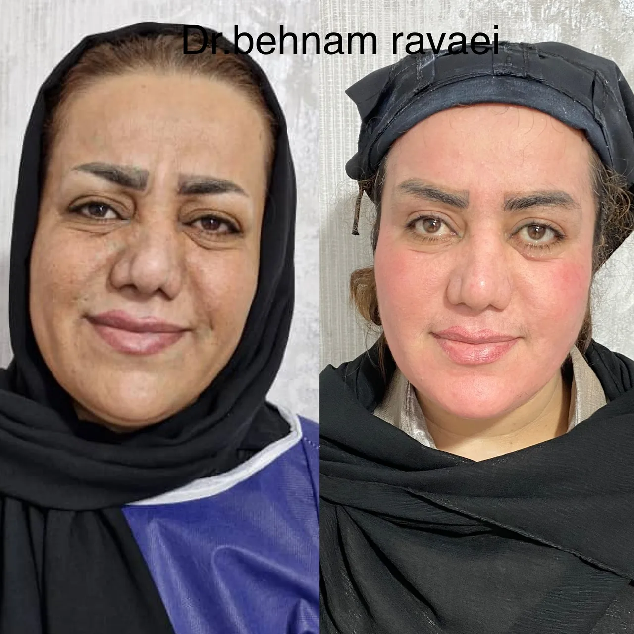 کلینیک زیبایی رایدو دکتر بهنام روایی - تصویر 5