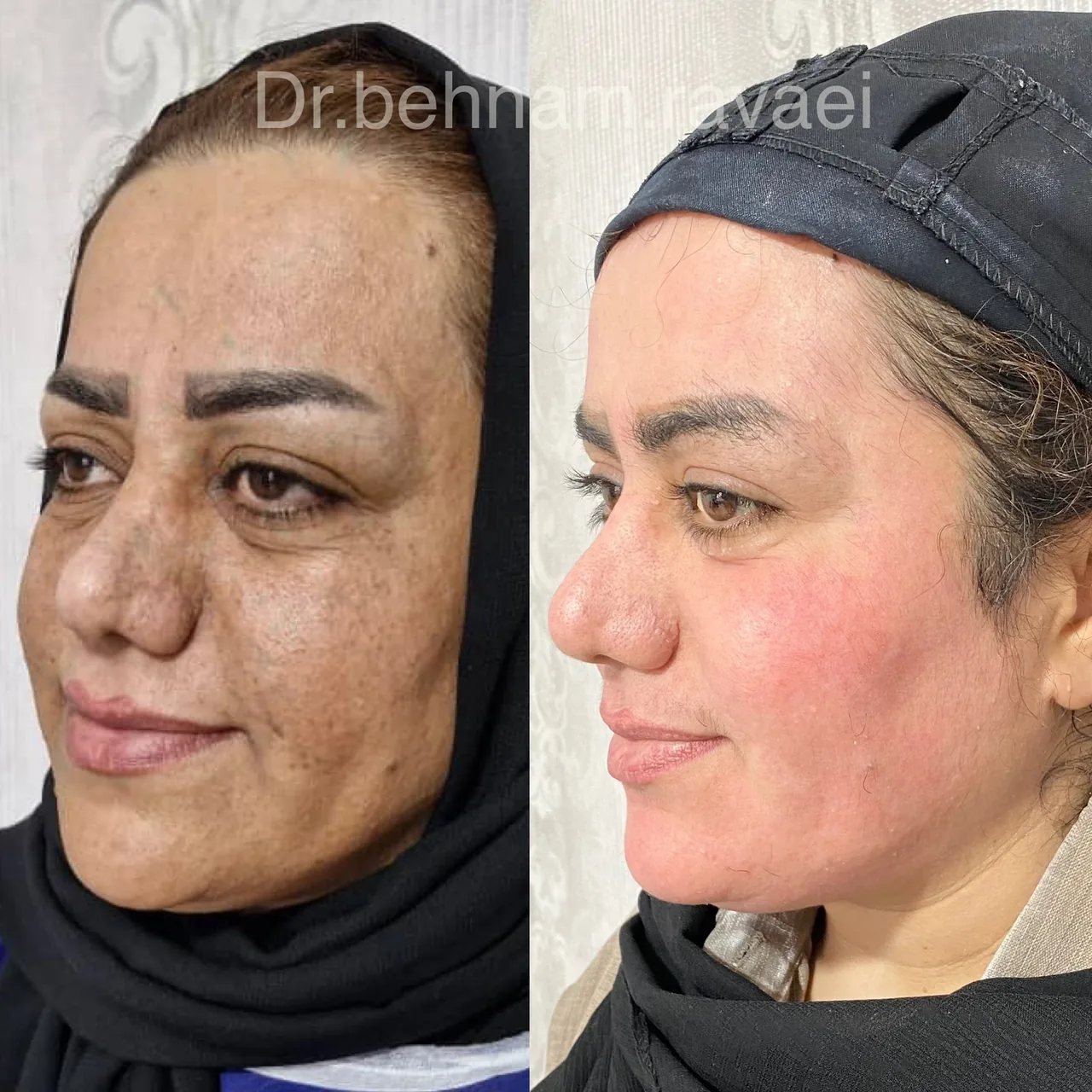 کلینیک زیبایی رایدو دکتر بهنام روایی - تصویر 6
