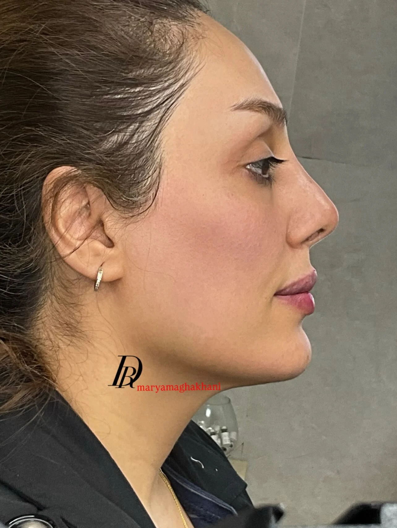 کلینیک تخصصی پوست و مو دکتر مریم آقاخانی - تصویر 3