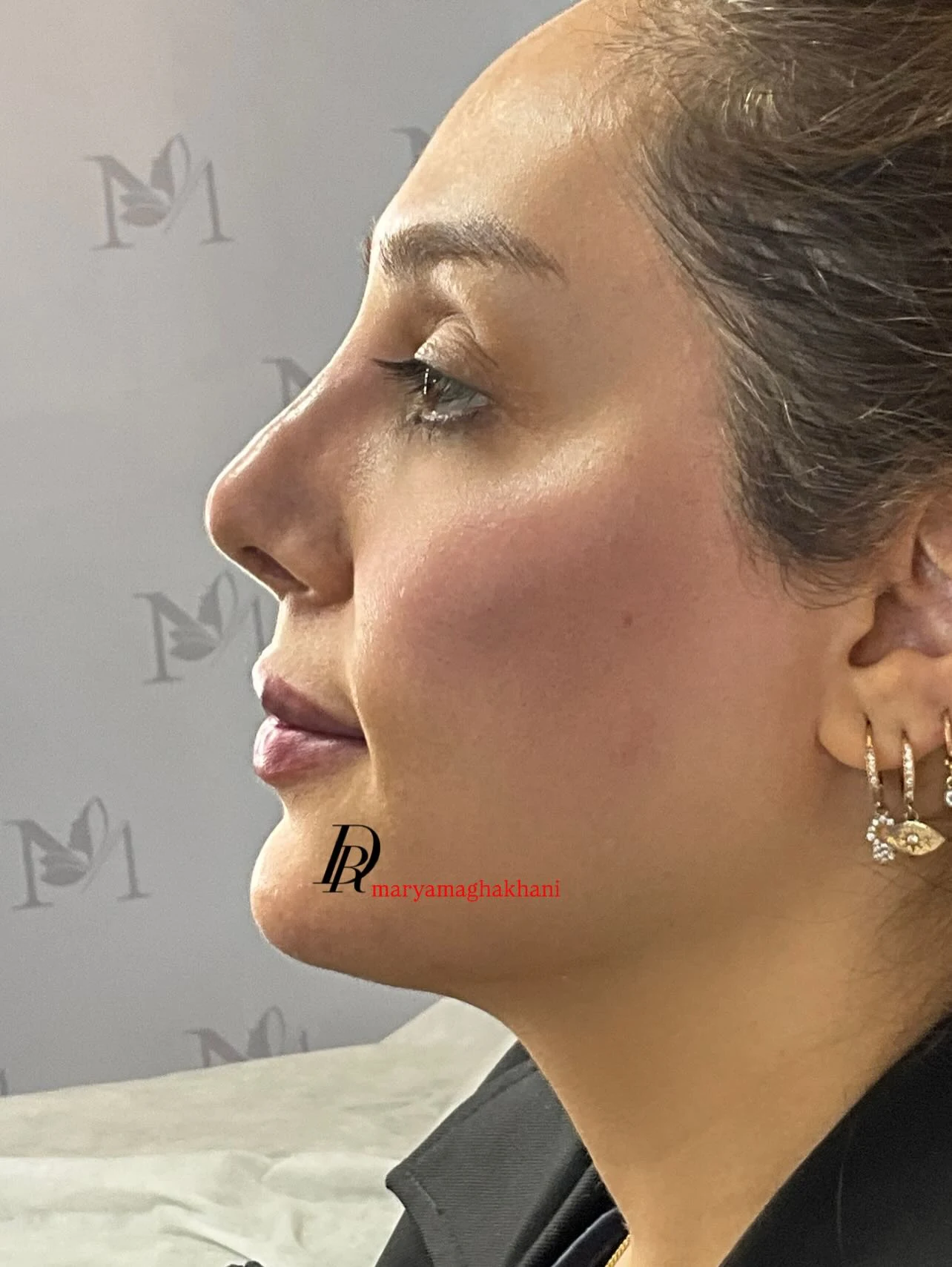 کلینیک تخصصی پوست و مو دکتر مریم آقاخانی - تصویر 4