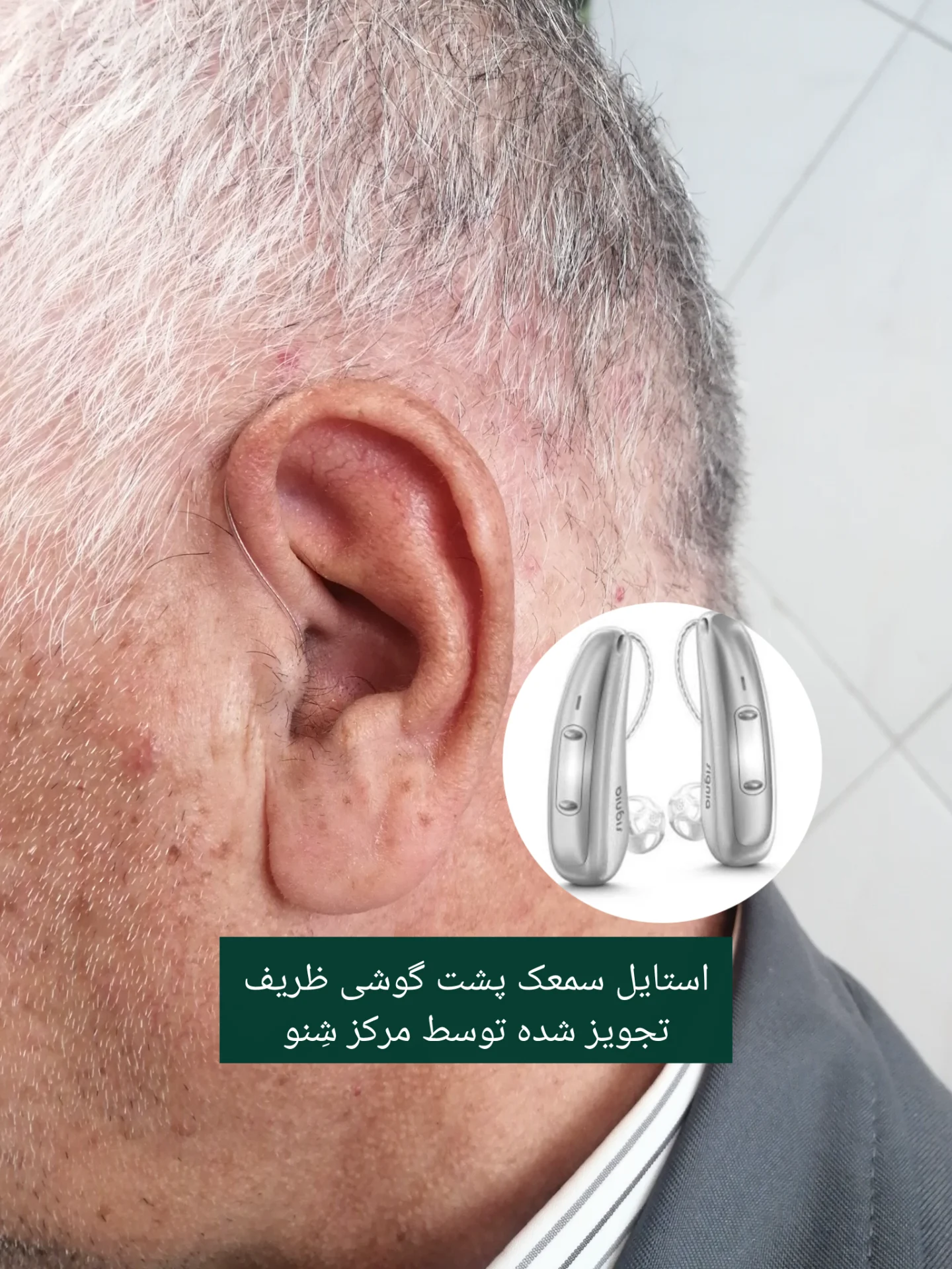 شنوایی سنجی و سمعک شِنو - تصویر 4