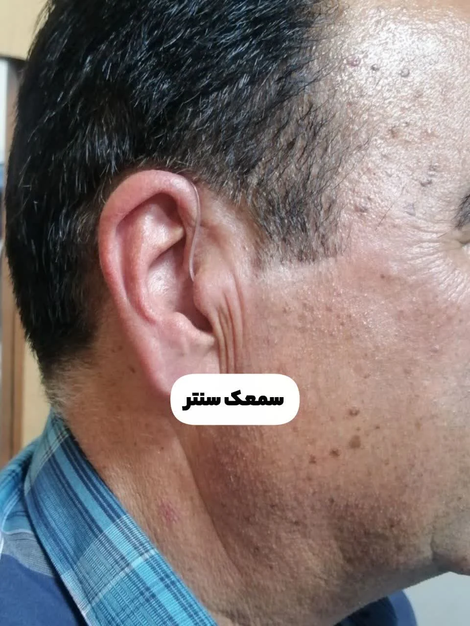سمعک سنتر - تصویر 2