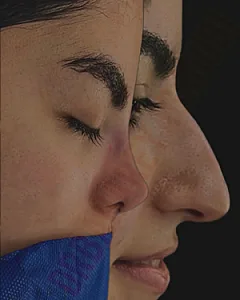 دکتر بهاره یعقوبی