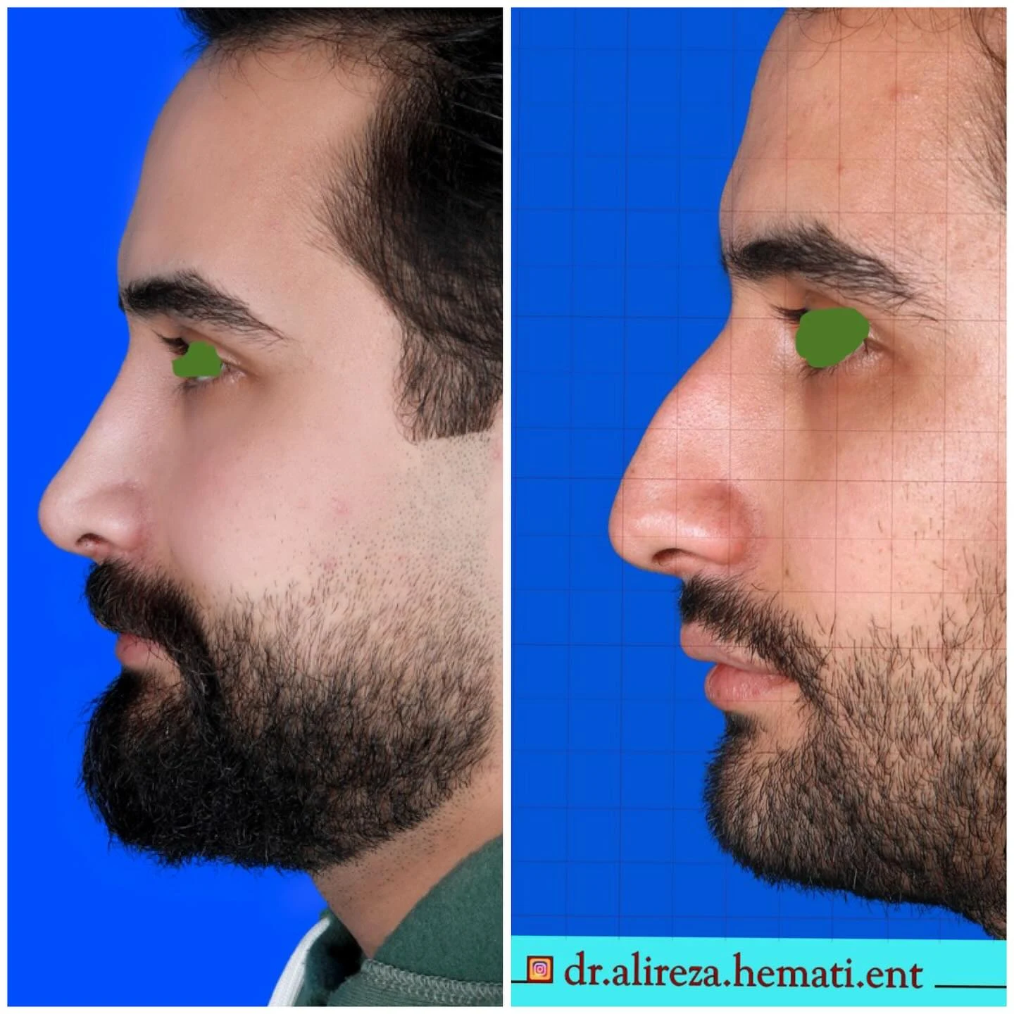 دکتر علیرضا همتی - تصویر 3