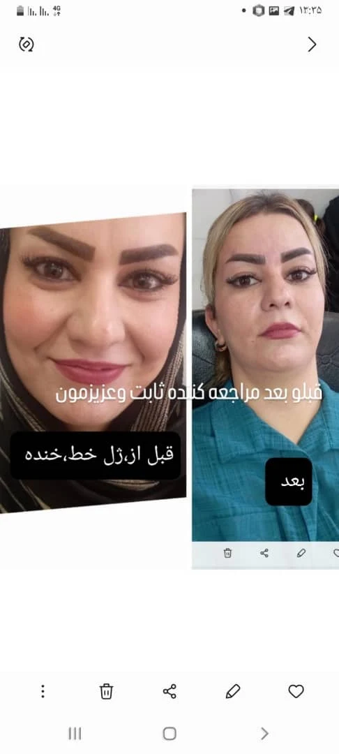 سالن هانی گل - تصویر 4