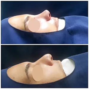 جراح بینی دکتر امیر فصیحی