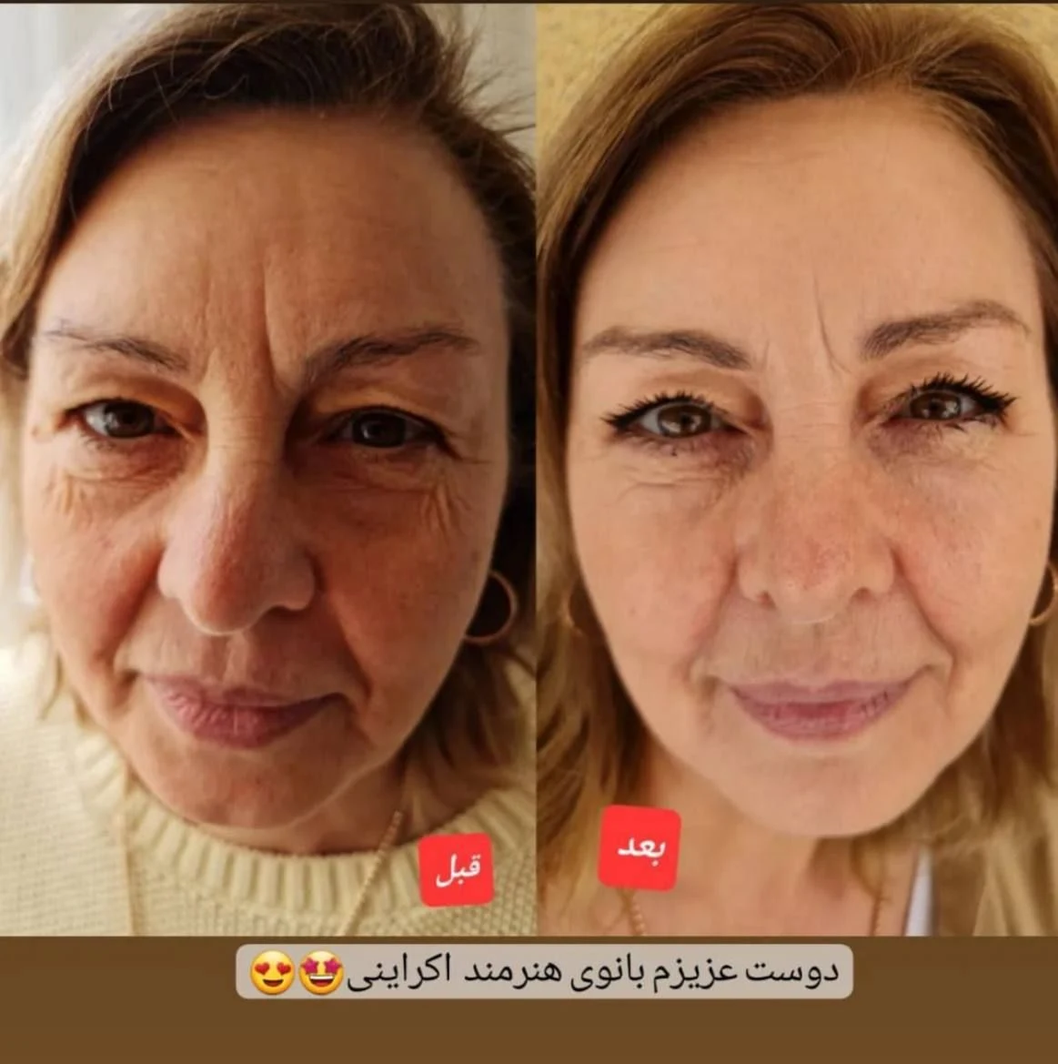 مشاور پوست مو و زیبایی لیلا کریمنژاد - تصویر 3