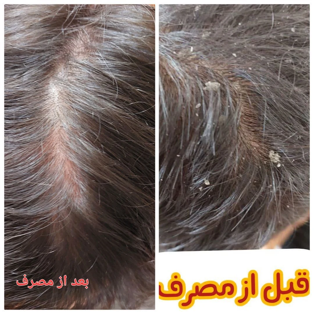 مشاور پوست مو و زیبایی لیلا کریمنژاد - تصویر 4