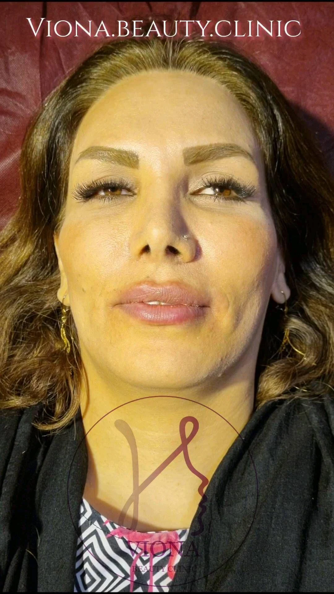 کلینیک زیبایی دکتر احیا