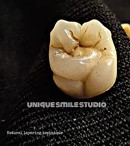 لابراتوار و میلینگ سنتر یونیک اسمایل