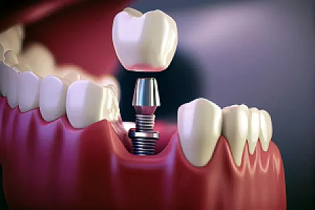 دندانپزشکی دلیار