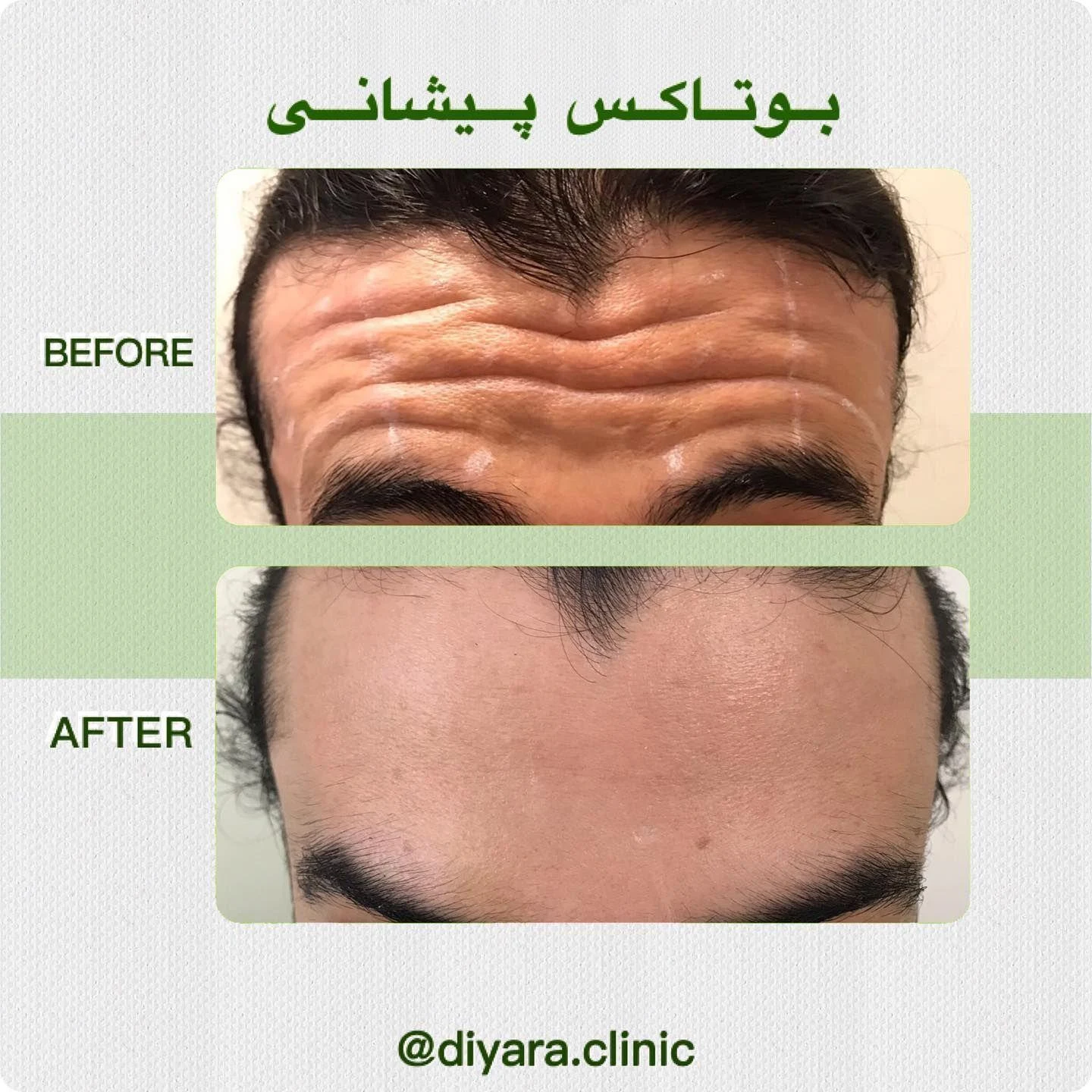 مرکز لیزر ، پوست و مو  دیارا - کلینیک پوست و زیبایی در تهران - تصویر 4